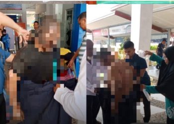 Insiden Kapal Aceh Hebat II, 14 Korban Alami Luka Bakar